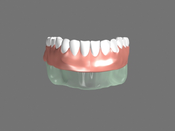 3d이빨소스, 3d치아소스,3d잇몸소스,3d의치소스,3d털니소스,3d인플란트, 3d max 모델링 소스